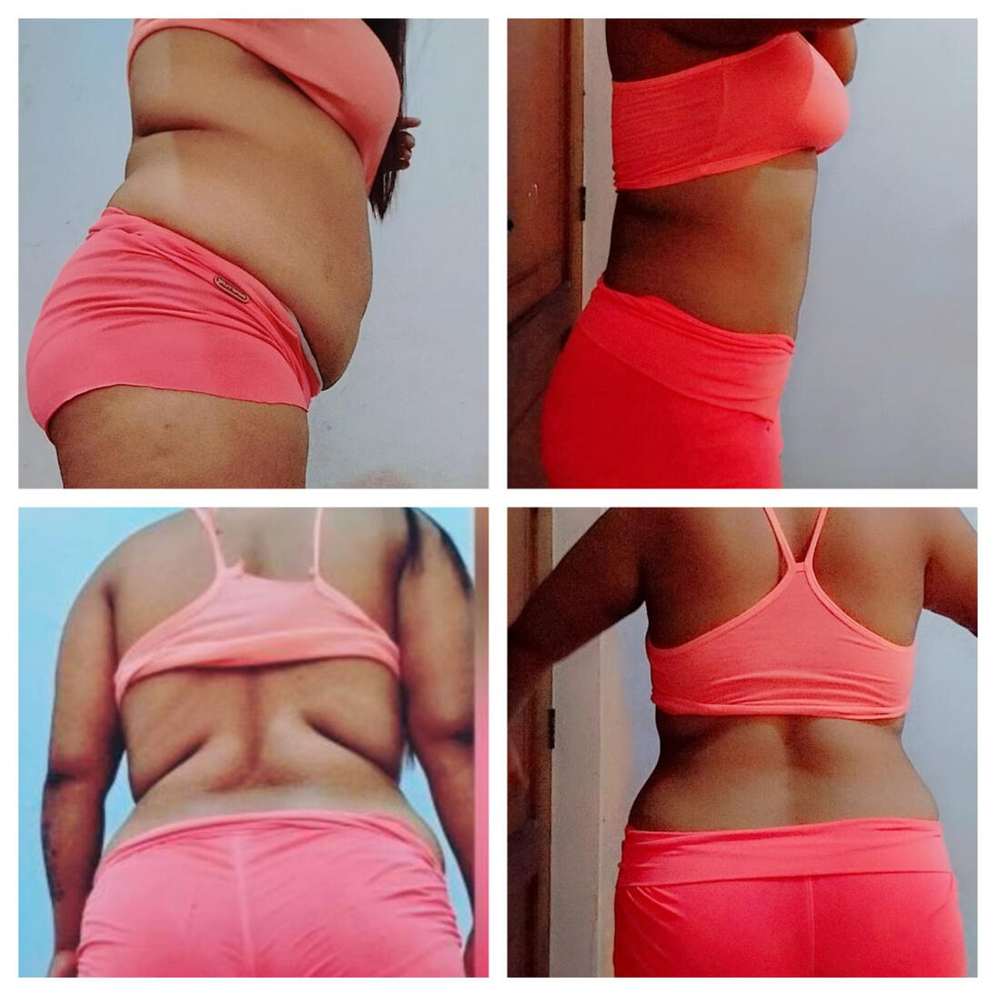 ANTES DESPUES