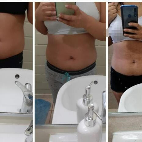 ANTES DESPUES