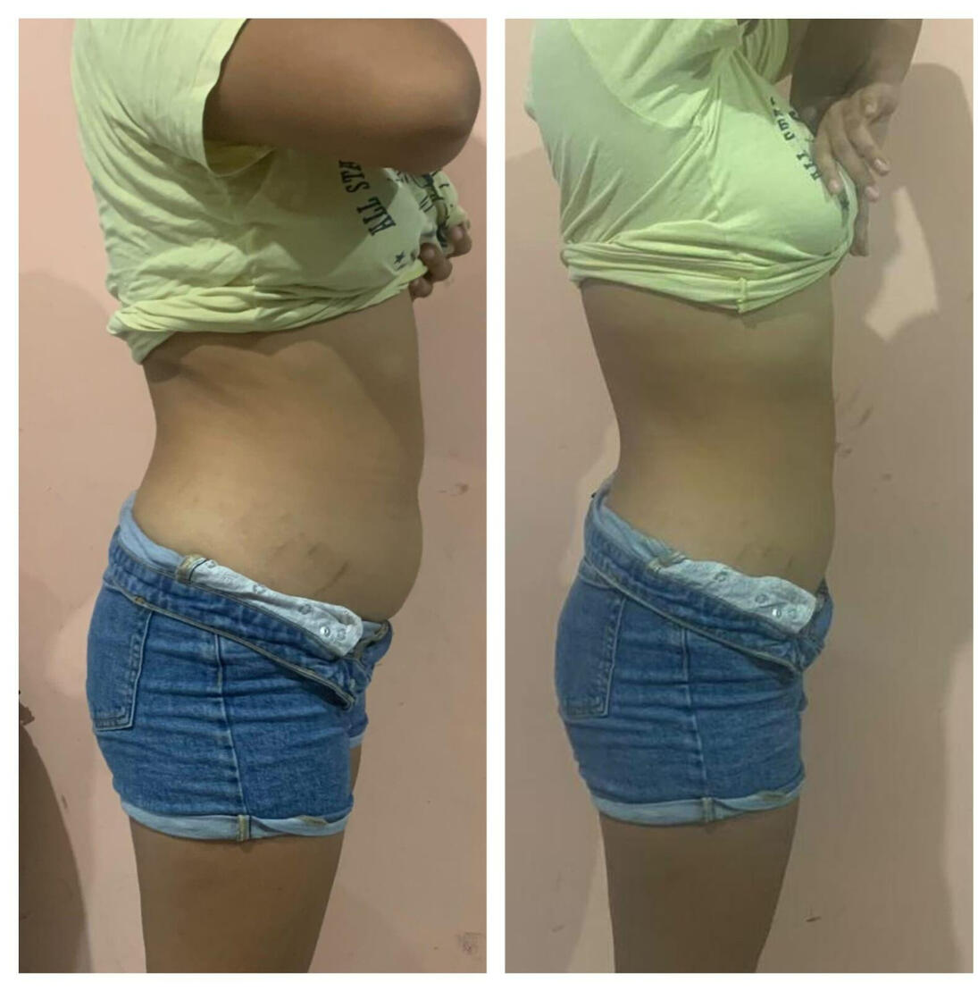 ANTES DESPUES